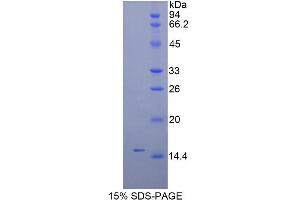 SDS-PAGE analysis of Mouse Inhibin beta C Protein. (INHBC Protein)