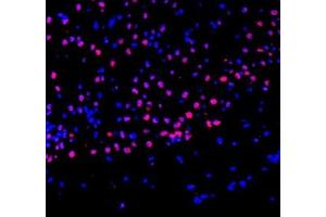 Immunofluorescence of paraffin embedded mouse brain using ZBTB40 (ABIN7076250) at dilution of 1:400 (300x lens) (ZBTB40 Antikörper)