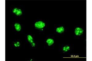 Immunofluorescence of purified MaxPab antibody to NOLC1 on HeLa cell. (NOLC1 Antikörper  (AA 1-700))