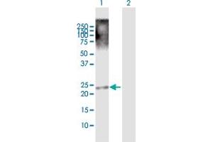 Western Blot analysis of TRIML1 expression in transfected 293T cell line by TRIML1 MaxPab polyclonal antibody. (TRIML1 Antikörper  (AA 1-192))