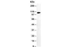 Western blot testing of DPYD antibody and MM231 cell lysate (DPYD Antikörper  (AA 33-52))