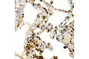 Immunohistochemistry of paraffin-embedded human normal lung using TFDP1 antibody at dilution of 1:200 (400x lens). (DP1 Antikörper)
