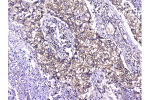 IHC analysis of TCP1 alpha using anti-TCP1 alpha antibody . (TCP1 alpha/CCTA Antikörper  (C-Term))