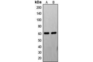 Western blot analysis of FAST Kinase expression in PC12 (A), HL60 (B) whole cell lysates.