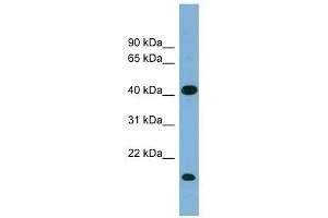 BXDC2 antibody used at 1 ug/ml to detect target protein. (BRIX1 Antikörper  (Middle Region))