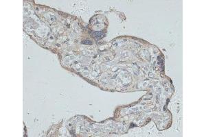 Immunohistochemistry of paraffin-embedded Human placenta using GMPR Polyclonal Antibody at dilution of 1:100 (40x lens). (GMPR Antikörper)