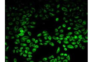 Detection of PIK3AP1 in Human Hela Cells using Polyclonal Antibody to Phosphoinositide-3-Kinase Adaptor Protein 1 (PIK3AP1) (PIK3AP1 Antikörper  (AA 489-730))