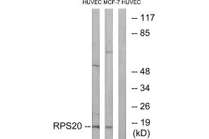 Western blot analysis of extracts from HUVEC cells and MCF-7 cells, using RPS20 antibody. (RPS20 Antikörper  (Internal Region))