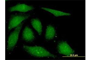 Immunofluorescence of monoclonal antibody to FGF1 on HeLa cell. (FGF1 Antikörper  (AA 46-155))