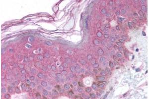 Human Skin (formalin-fixed, paraffin-embedded) stained with BARD1 antibody ABIN214634 at 10 ug/ml followed by biotinylated goat anti-rabbit IgG secondary antibody ABIN481713, alkaline phosphatase-streptavidin and chromogen. (BARD1 Antikörper  (AA 108-124))