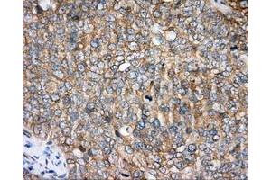 Immunohistochemistry (IHC) image for anti-Bruton Agammaglobulinemia tyrosine Kinase (BTK) antibody (ABIN1496974) (BTK Antikörper)