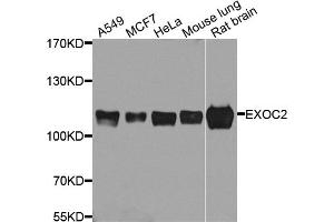 Western blot analysis of extracts of various cell lines, using EXOC2 antibody. (EXOC2 Antikörper)