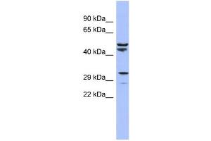 WB Suggested Anti-MRPS15 Antibody Titration:  0. (MRPS15 Antikörper  (N-Term))