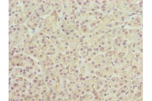 Immunohistochemistry of paraffin-embedded human pancreatic tissue using ABIN7173131 at dilution of 1:100 (TMEM25 Antikörper  (AA 104-153))
