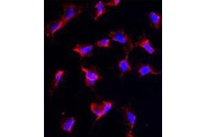 Image no. 3 for anti-Nanos Homolog 1 (NANOS1) (C-Term) antibody (ABIN356876) (Nanos Homolog 1 Antikörper  (C-Term))