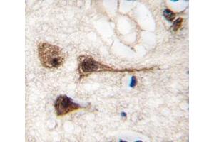 IHC analysis of FFPE human brain tissue stained with MEF2C antibody (MEF2C Antikörper  (AA 278-307))