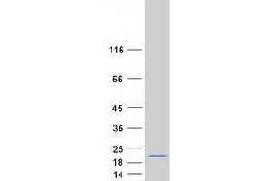 Validation with Western Blot (REG3g Protein (Transcript Variant 2) (Myc-DYKDDDDK Tag))