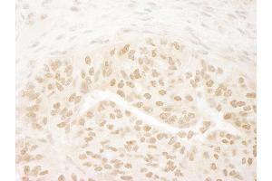 anti-DOT1-Like, Histone H3 Methyltransferase (S. Cerevisiae) (DOT1L) (AA 1000-1050) antibody