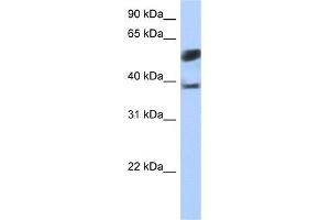 WB Suggested Anti-SPOPL Antibody Titration:  0. (SPOPL Antikörper  (N-Term))
