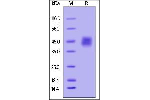 SDS-PAGE (SDS) image for Interleukin 4 Receptor (IL4R) (AA 26-232) (Active) protein (His tag,AVI tag,Biotin) (ABIN4949032)