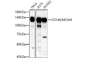 Western blot analysis of extracts of various cell lines, using CD146/MCAM antibody (ABIN6127568, ABIN6143621, ABIN6143622 and ABIN6218100) at 1:500 dilution. (MCAM Antikörper  (AA 447-646))