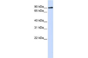 WB Suggested Anti-DCLRE1C Antibody Titration:  0. (DCLRE1C Antikörper  (N-Term))