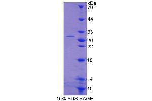 SDS-PAGE analysis of Human ACAA1 Protein. (ACAA1 Protein)