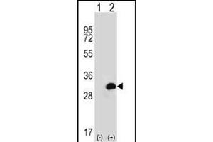 Western blot analysis of CA1 (arrow) using rabbit polyclonal CA1 Antibody (N-term) (ABIN656574 and ABIN2845835). (CA1 Antikörper  (N-Term))
