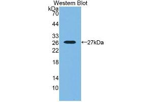 Western blot analysis of the recombinant protein. (SNX18 Antikörper  (AA 411-614))