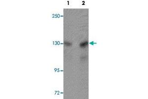 Western blot analysis of A-20 cells with MTUS2 polyclonal antibody  at (Lane 1) 0. (CAZIP Antikörper  (C-Term))