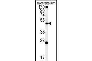 Western blot analysis of ENPP6 Antibody in mouse cerebellum tissue lysates (35ug/lane) (ENPP6 Antikörper  (AA 170-197))