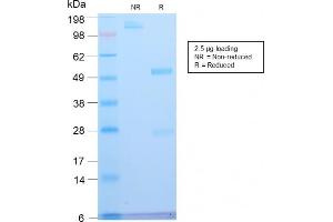 SDS-PAGE Analysis Purified ATRX Rabbit Recombinant Monoclonal Antibody (ATRX/2900R). (Rekombinanter ATRX Antikörper)