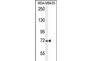 Western blot analysis in MDA-MB435 cell line lysates (35ug/lane). (ARHGAP10 Antikörper  (AA 237-263))