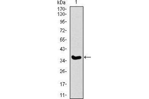 Western blot analysis using ITGA2B mAb against human ITGA2B recombinant protein. (Integrin Alpha2b Antikörper  (AA 45-149))