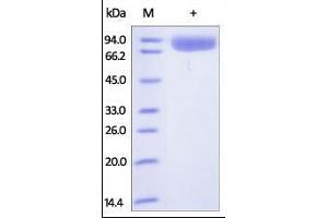 Human pIgR, His Tag on SDS-PAGE under reducing (R) condition. (PIGR Protein (AA 19-638) (His tag))