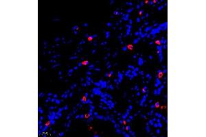 Immunofluorescence of paraffin embedded human stomach using GLP1 (ABIN7074053) at dilution of 1:500 (400x lens) (GLP-1 Antikörper)
