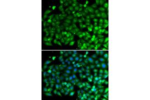 Immunofluorescence analysis of A549 cells using SH3GLB1 antibody (ABIN5974271). (SH3GLB1 Antikörper)