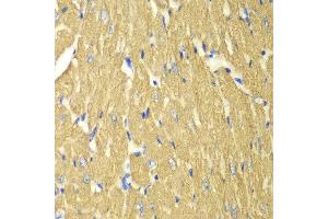 Immunohistochemistry (IHC) image for anti-Tropomyosin 3 (TPM3) (AA 1-284) antibody (ABIN6215629) (TPM3 Antikörper  (AA 1-284))