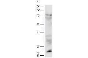 Lane 1: mouse lung probed with Rabbit Anti-Sclerostin Polyclonal Antibody, Unconjugated  at 1:5000 for 90 min at 37˚C. (Sclerostin Antikörper  (AA 121-180))
