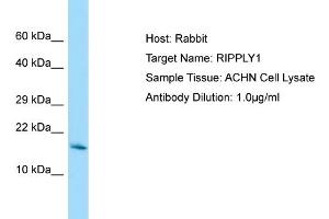 Host: Rabbit Target Name: RIPPLY1 Sample Tissue: Human ACHN Whole Cell Antibody Dilution: 1ug/ml (RIPPLY1 Antikörper  (Middle Region))