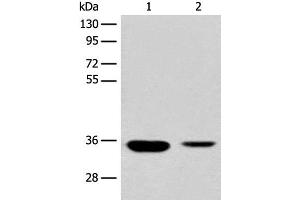 Western blot analysis of Mouse liver tissue and Human fetal liver tissue lysates using RGN Polyclonal Antibody at dilution of 1:500 (Regucalcin Antikörper)