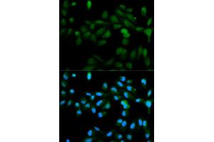 Immunofluorescence analysis of MCF-7 cells using CYP11A1 antibody (ABIN5970856). (CYP11A1 Antikörper)