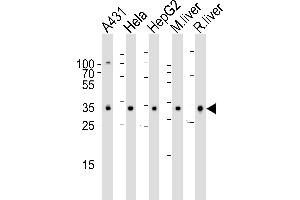 Western blot analysis of lysates from A431, Hela, HepG2 cell line , mouse liver and rat liver tissue lysate(from left to right), using CYB5R3 Antibody (Center) (ABIN6242253 and ABIN6577413). (CYB5R3 Antikörper  (AA 111-144))
