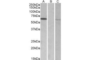 HEK293 lysate (10ug protein in RIPA buffer) over expressing Human MKRN1 with DYKDDDDK tag probed with ABIN2563878 (0. (MKRN1 Antikörper  (AA 105-118))