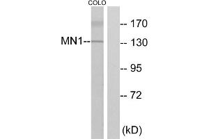Western blot analysis of extracts from COLO cells, using MN1 antibody. (Meningioma 1 Antikörper  (Internal Region))