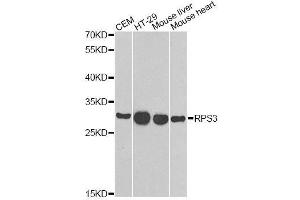 Western blot analysis of extracts of various cell lines, using RPS3 antibody. (RPS3 Antikörper  (AA 1-243))