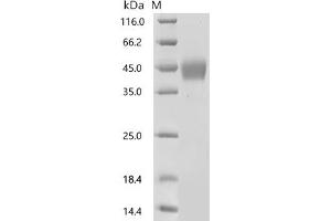(Tris-Glycine gel) Discontinuous SDS-PAGE (reduced) with 5 % enrichment gel and 15 % separation gel.
