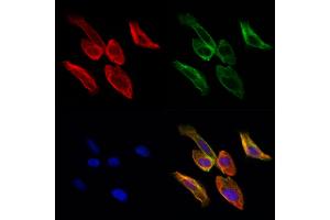 ABIN6261947 and ABIN6276873 staining Hela cells by IF/ICC. (GGT1 Antikörper  (N-Term))
