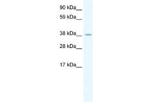 HSFY2 antibody (20R-1152) used at 0. (HSFY2 Antikörper  (C-Term))