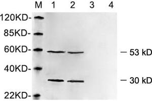 Western blot analysis of cell lysates using 1 µg/mL Rabbit Anti-Vimentin Polyclonal Antibody (ABIN398721) Lane 1, 3: Hela cell lysateLane 2, 4: HEK293 cell lysate Primary antibody: Lane 1, 2: Rabbit Anti-Vimentin Polyclonal AntibodyLane 3, 4: Rabbit Anti-Vimentin Polyclonal Antibody pre-incubated with immunizing peptideThe signal was developed with IRDyeTM 800 Conjugated Goat Anti-Rabbit IgG. (Vimentin Antikörper  (AA 400-500))